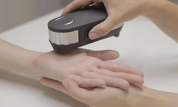 oligoscan test